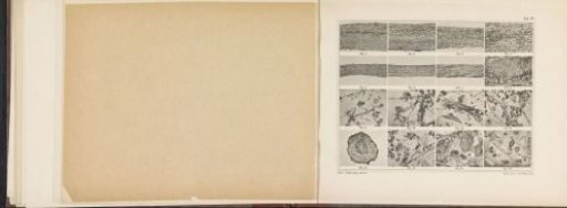 Sheet with sixteen microscopic photographs of cinnamon