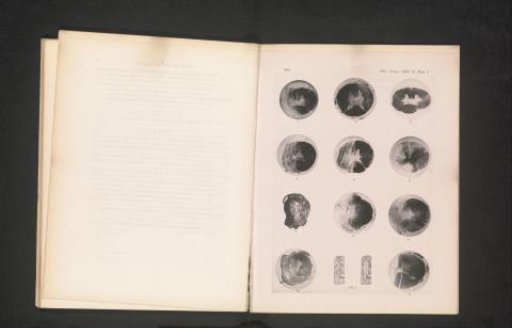 Eleven cross-sections of damaged spines of monkeys