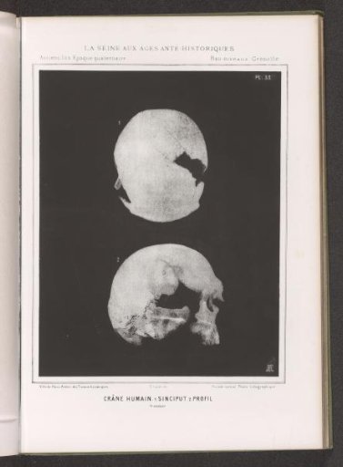 Two views of a human skull, top view and profile