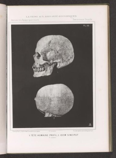 Two views of a human skull, profile and top view