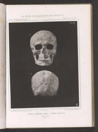 Two views of a human skull, front and back view