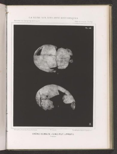 Two views of a human skull, top view and profile