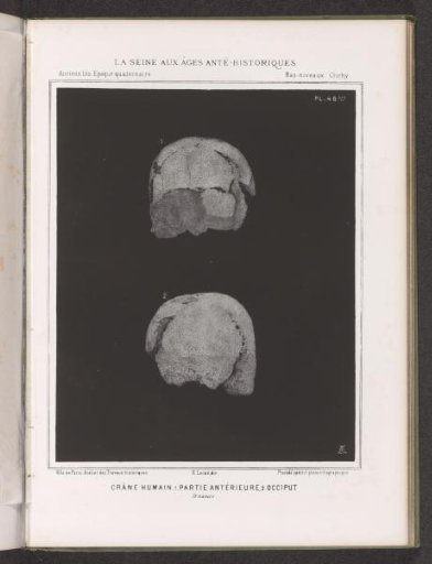Two views of a human skull, front view and back view
