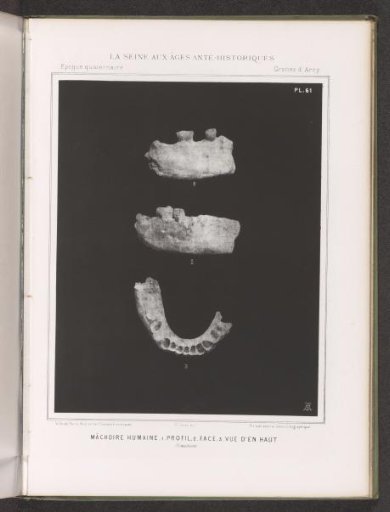 Three views of a human jaw, side view, front view, top view