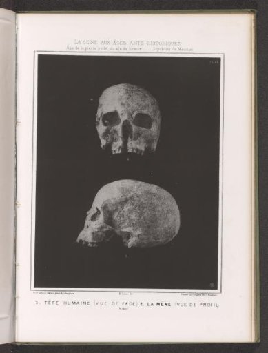 Two views of a human skull, front view and profile