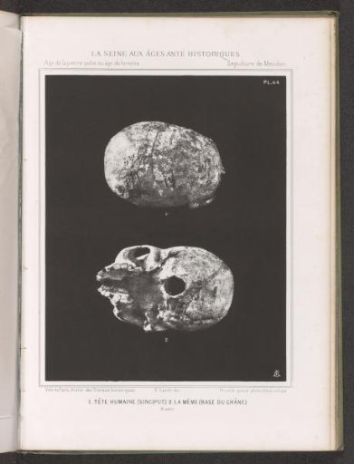 Two views of a human skull, top view and skull base