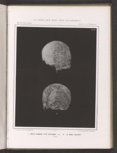 Two views of a human skull, front and back