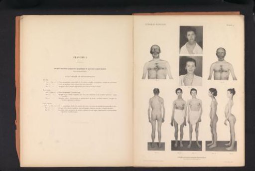 Nine views of an unknown man and women with muscular atrophy
