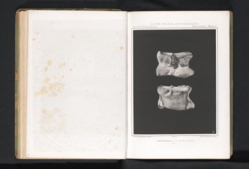 Two dislocated leg bones of an aurochs