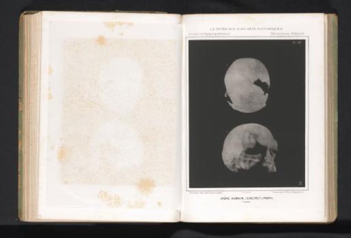 Two views of a human skull, top view and profile