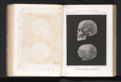 Two views of a human skull, profile and top view