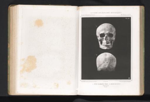 Two views of a human skull, front view and back view