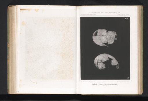 Two views of a human skull, top view and profile
