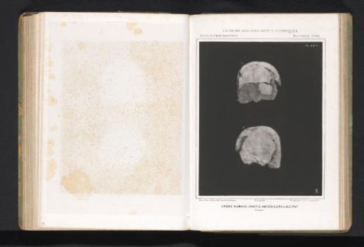 Two views of a human skull, front view and back view