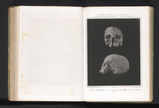 Two views of a human skull