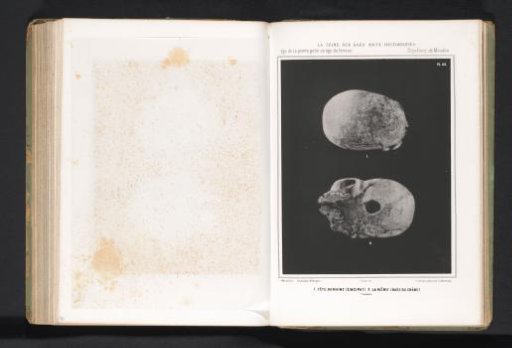 Two views of a human skull