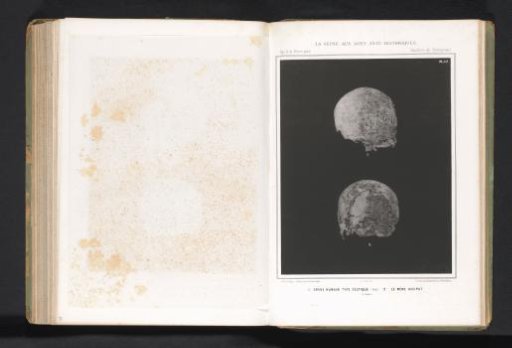 Two views of a human skull