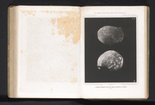 Two views of a human skull