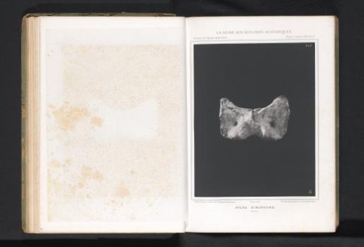 Atlas from the spine of an aurochs