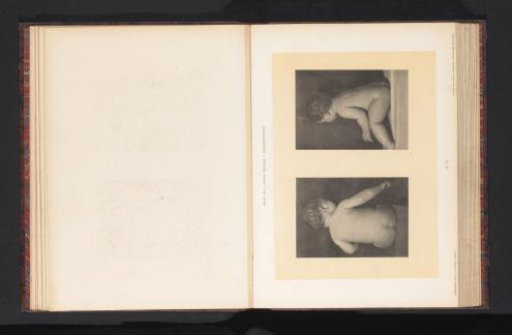 Two images of a seated nude boy, viewed from the back