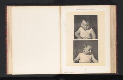 Two images of a seated child