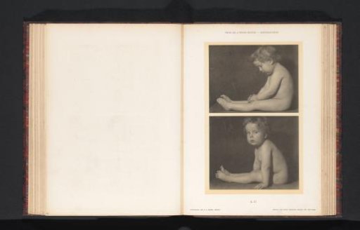 Two images of a seated nude child