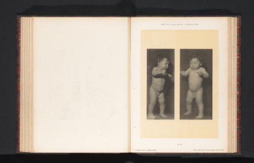 Two images of a standing nude boy