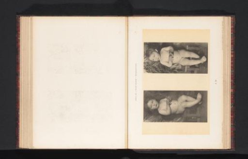 Two images of a nude girl, seated on a chair