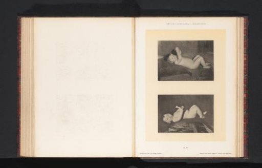 Two images of a reclining nude child