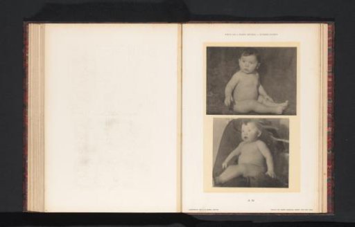 Two images of a seated nude boy