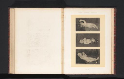 Three images of a reclining nude girl