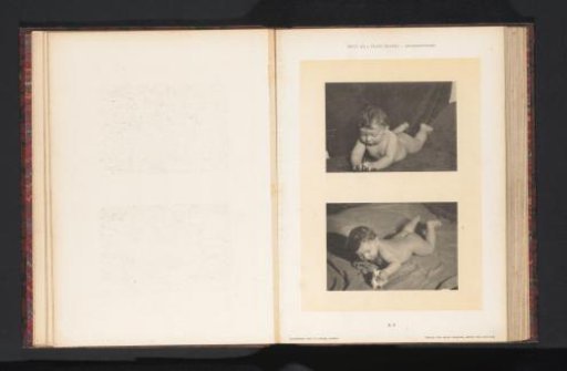 Two images of a lying nude boy