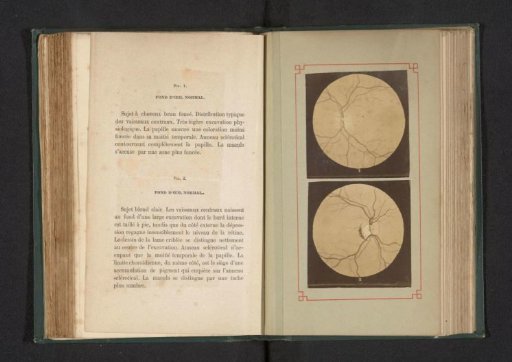 Photographic Reproduction of Two Anatomical Drawings of a Normal Eye