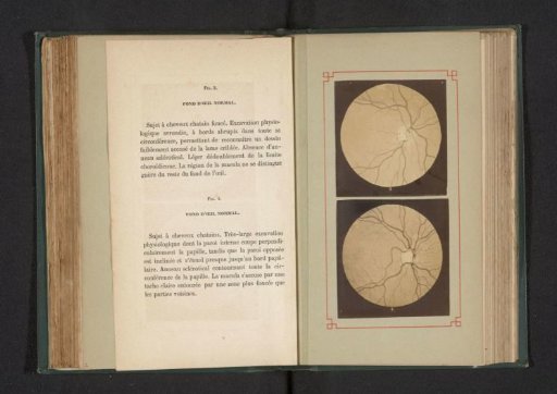 Photographic Reproduction of Two Anatomical Drawings of a Normal Eye