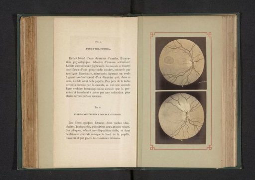 Photoreproduction of two anatomical drawings of a normal eye and the nerves in an eye