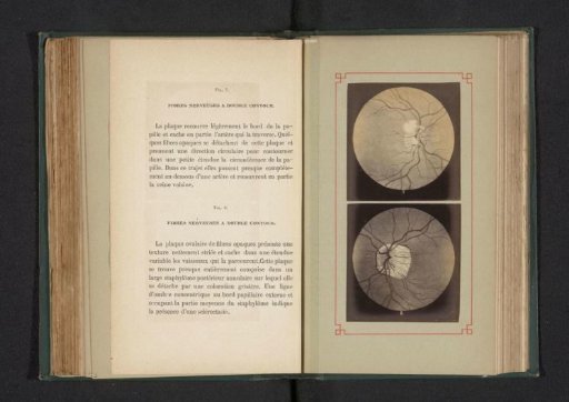 Photoreproduction of two anatomical drawings of the nerves in an eye