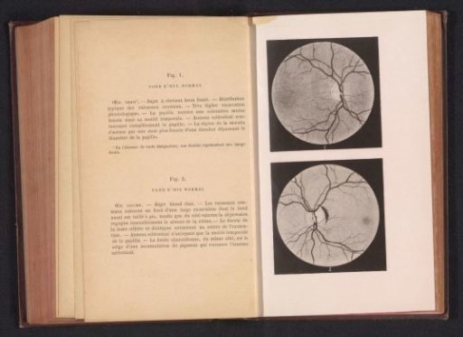 Photographic Reproduction of Two Anatomical Drawings of a Normal Eye