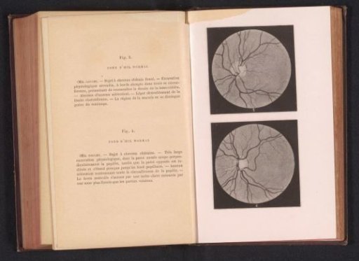 Photographic Reproduction of Two Anatomical Drawings of a Normal Eye