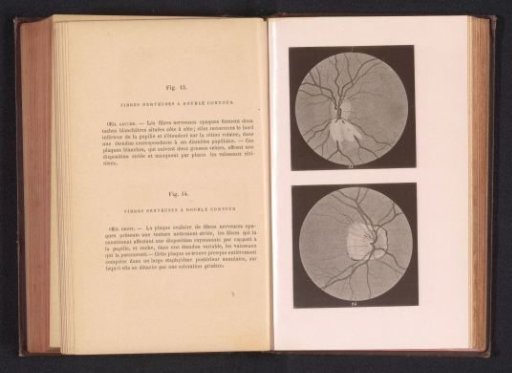Photographic reproduction of two anatomical drawings of nerves in an eye