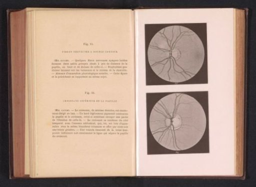 Photographic reproduction of two anatomical drawings of nerves in an eye