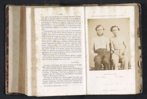 Portrait of two unknown men each missing a forearm