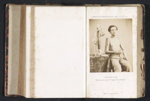 Portrait of an unknown man with an arm prosthesis