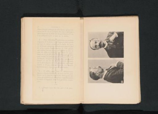 Two judicial portraits of an unknown man