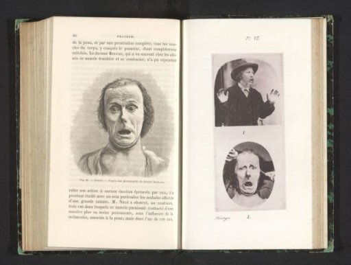 Two men with a startled facial expression