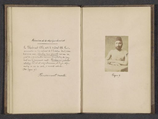 Portrait of Mehemet Ali, a patient after an operation on his humerus