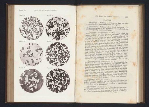 Six enlargements of blood cells
