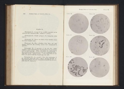 Six enlargements of colorless blood corpuscles