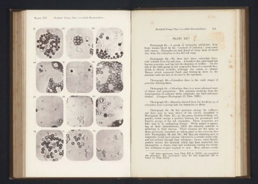Twelve enlargements of blood corpuscles