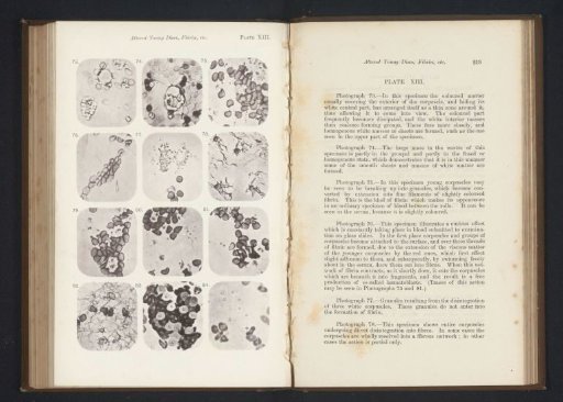 Twelve enlargements of red blood cells