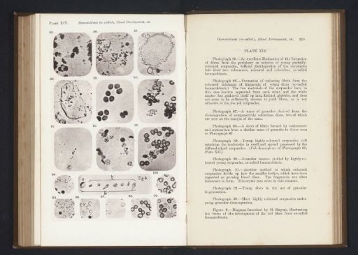 Eleven enlargements of red blood cells and fibrin, and a diagram